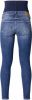 Noppies  Jeans Skinny Tara stone wash Blauw Gr.32 Meisjes online kopen