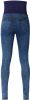 Supermom skinny zwangerschaps jegging stonewashed online kopen